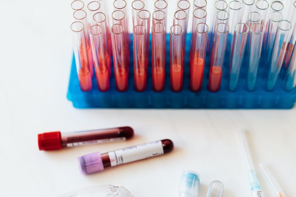 Understanding the Herpes Testing Methods