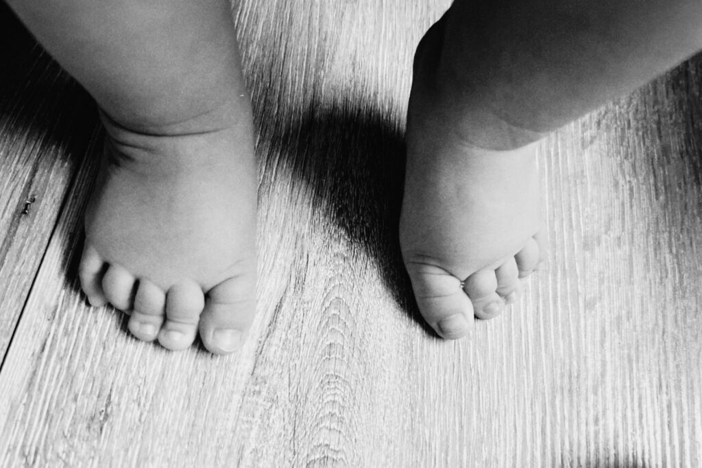 Illustration of baby walking on tiptoes: Why Toddlers Toe Walk, Stunning Causes