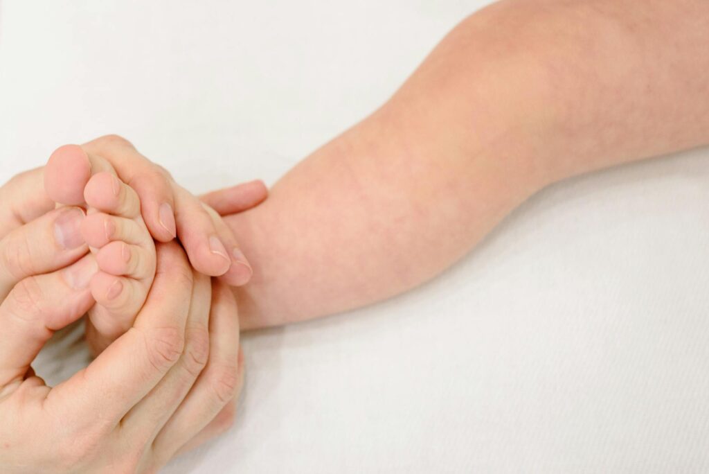 hand foot and mouth disease in children - AmyandRose Illustration of Hand Foot and Mouth Disease in Children: Symptoms & Treatment